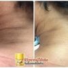 Marika Body Tonner-Thailand-ঘাড় ও বগলের কালো দাগ দূর করুন. image 2