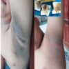 Marika Body Tonner-Thailand-ঘাড় ও বগলের কালো দাগ দূর করুন. image 5