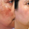 Ql Qian Li Whitening Cream-মেছতার দাগ দূর করুন image 2