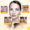 Ql Qian Li Whitening Cream-মেছতার দাগ দূর করুন image 4