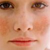 Ql Qian Li Whitening Cream-মেছতার দাগ দূর করুন image 5