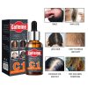 চুল পড়া বন্ধ ও নতুন চুল গজায়-Caffeine Essential Oil Anti Hair Loss-UK. image 3