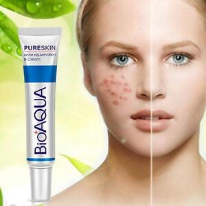 ব্রনের দাগ দূর করে 100% Orginal-Bioaqua Acne Spot Born Out.