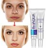 ব্রনের দাগ দূর করে 100% Orginal-Bioaqua Acne Spot Born Out. image 3