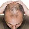 চুল পড়া বন্ধ ও নতুন চুল গজায় ১০০%-Dissar Essential Hair Oi-UAE. image 2