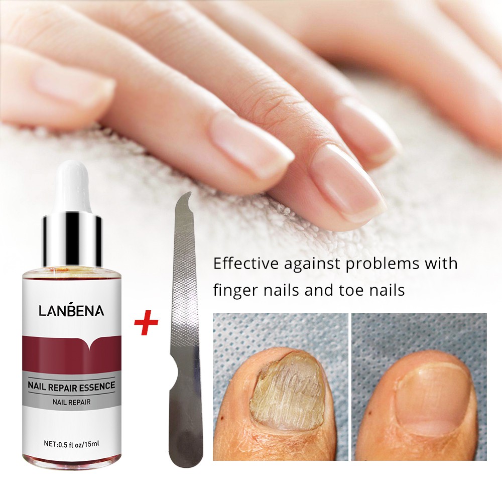 মরে যাওয়া নখকে সতেজ ও সুন্দর করে- LANBENA Nail Repair. image 2