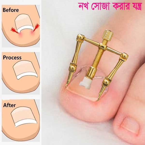 Nail Care Machine For Nail Repair image 2